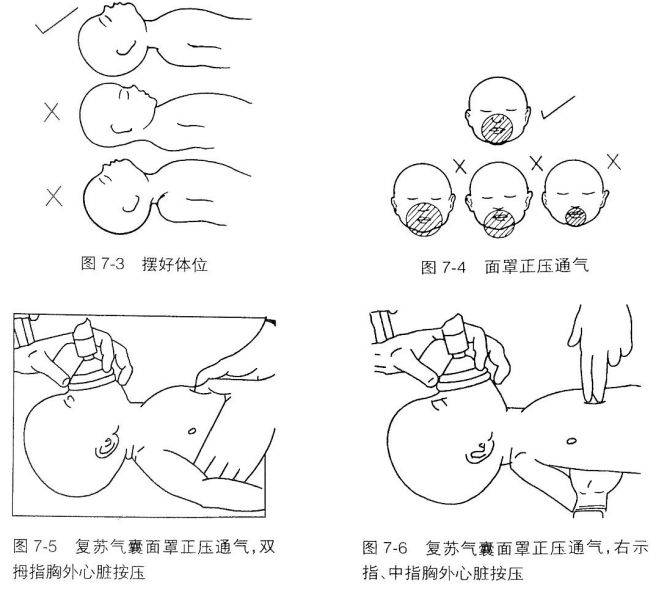 新生儿窒息复苏最新版的变革，自信与成就感的源泉
