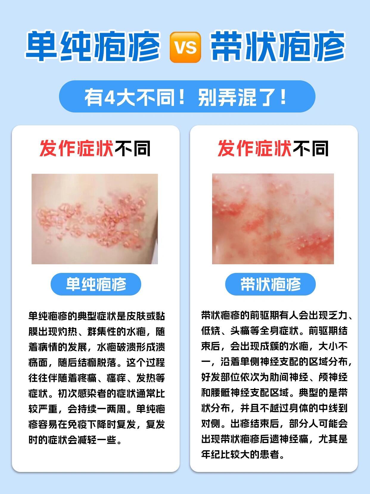 疱疹最新治疗进展，自信重塑，希望照亮未来之路